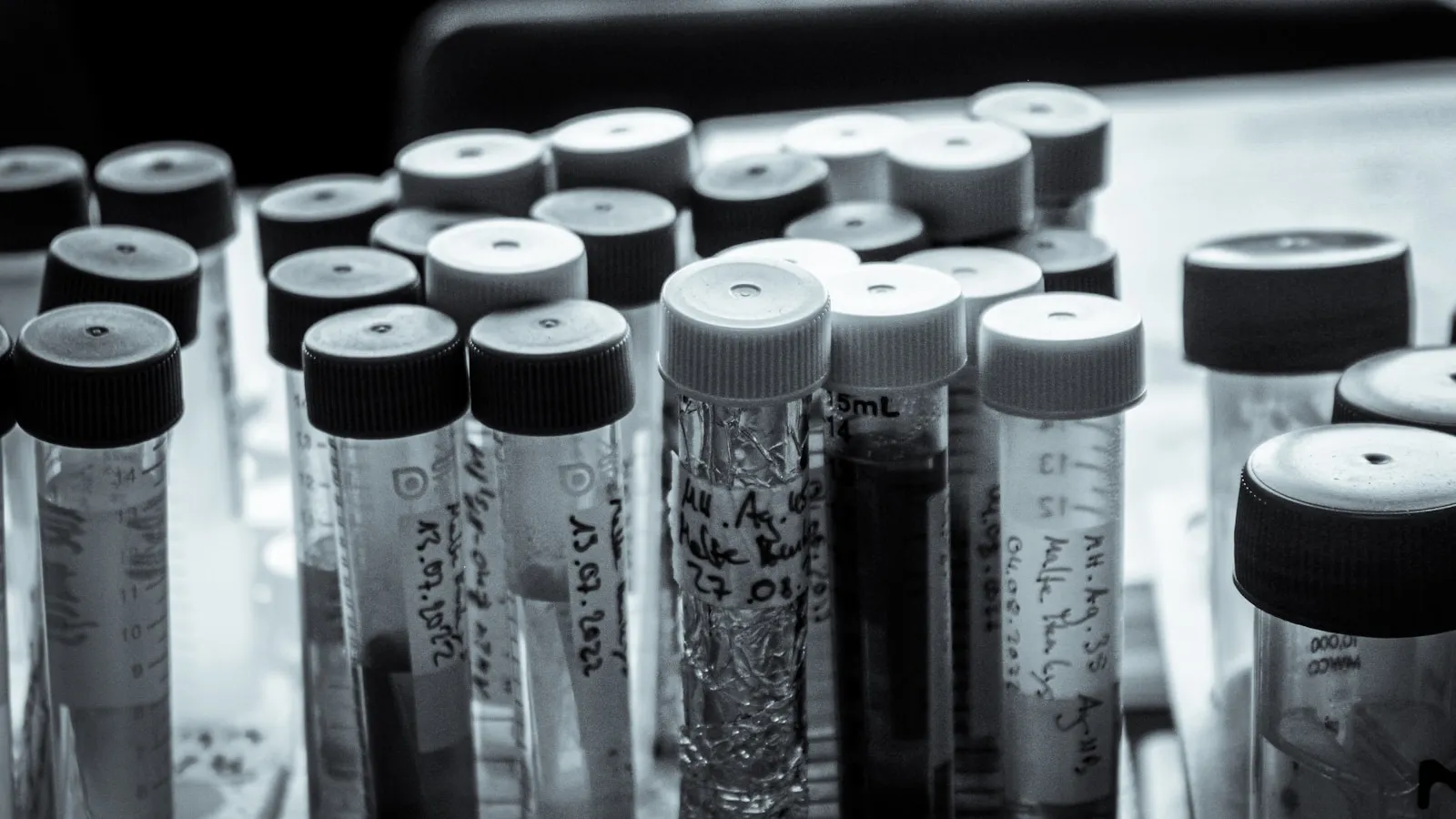 Anti-HBs: what your antibody level says about protection
