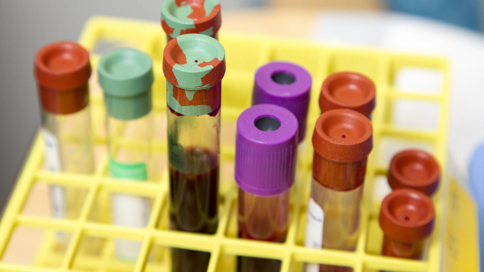 Heldere reageerbuizen voor laboratoriumonderzoek.