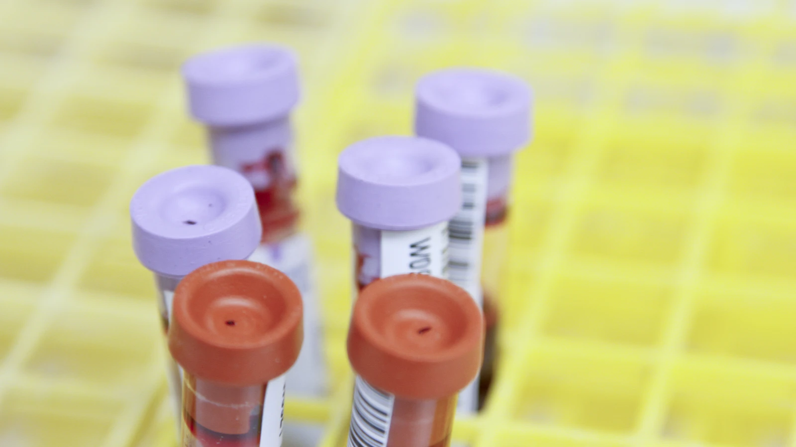 Labelled tubes of blood samples standing upright in a yellow laboratory rack.