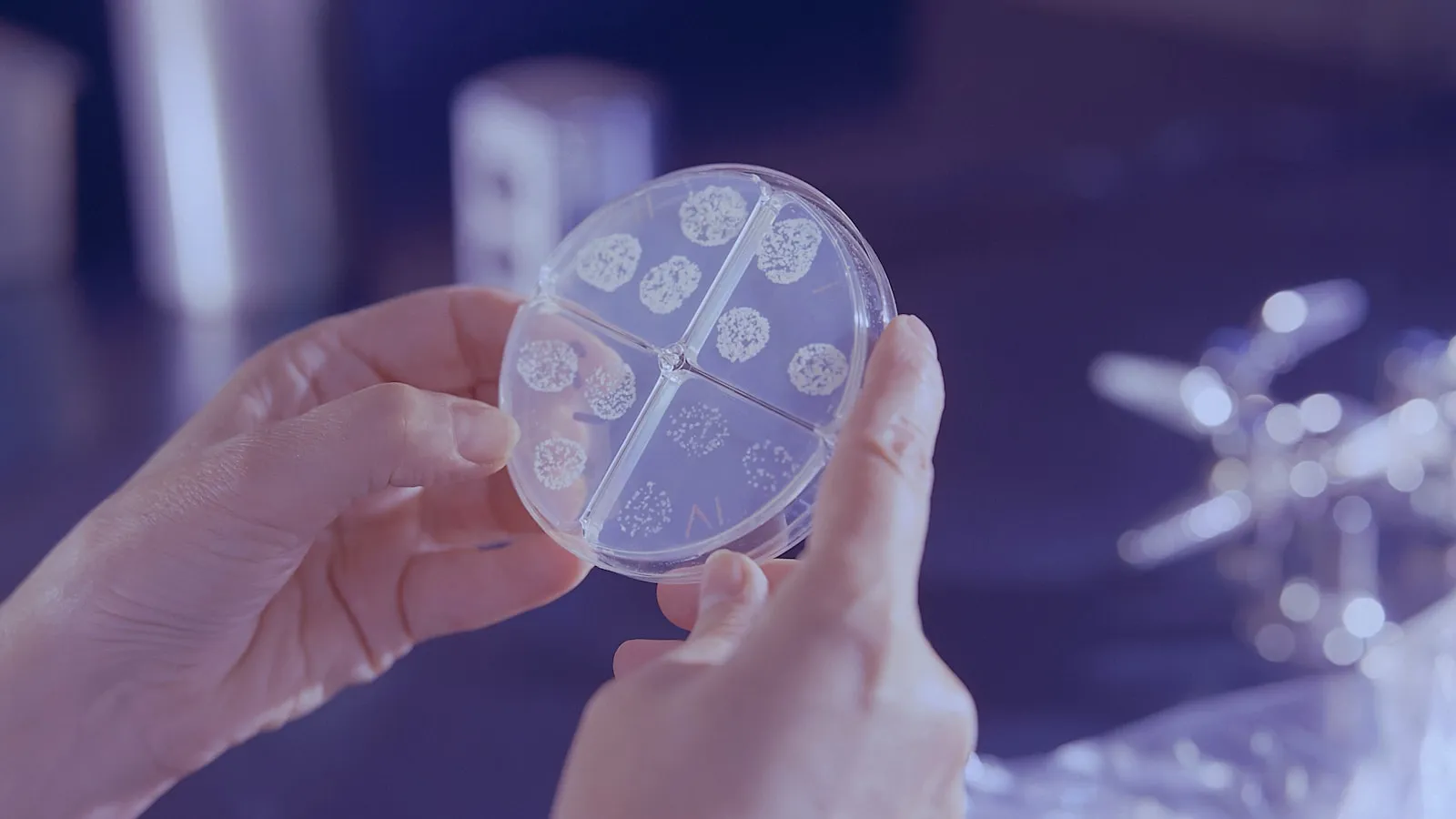 Ureaplasma urealyticum: normaal of toch behandelen?