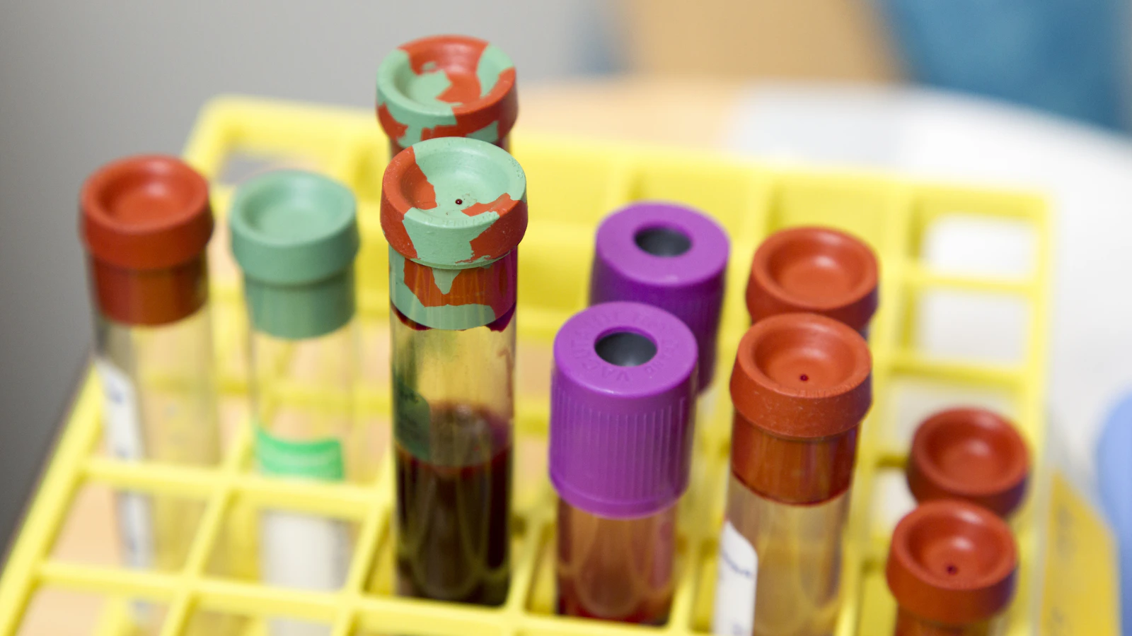Rek met bloedbuisjes met gekleurde doppen in een laboratorium.